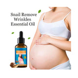 Aichun Beauty Natural Snail Removes Pregnancy Stretch Marks Essential Oil 30Ml