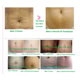 Aichun Beauty Natural Snail Removes Pregnancy Stretch Marks Essential Oil 30Ml